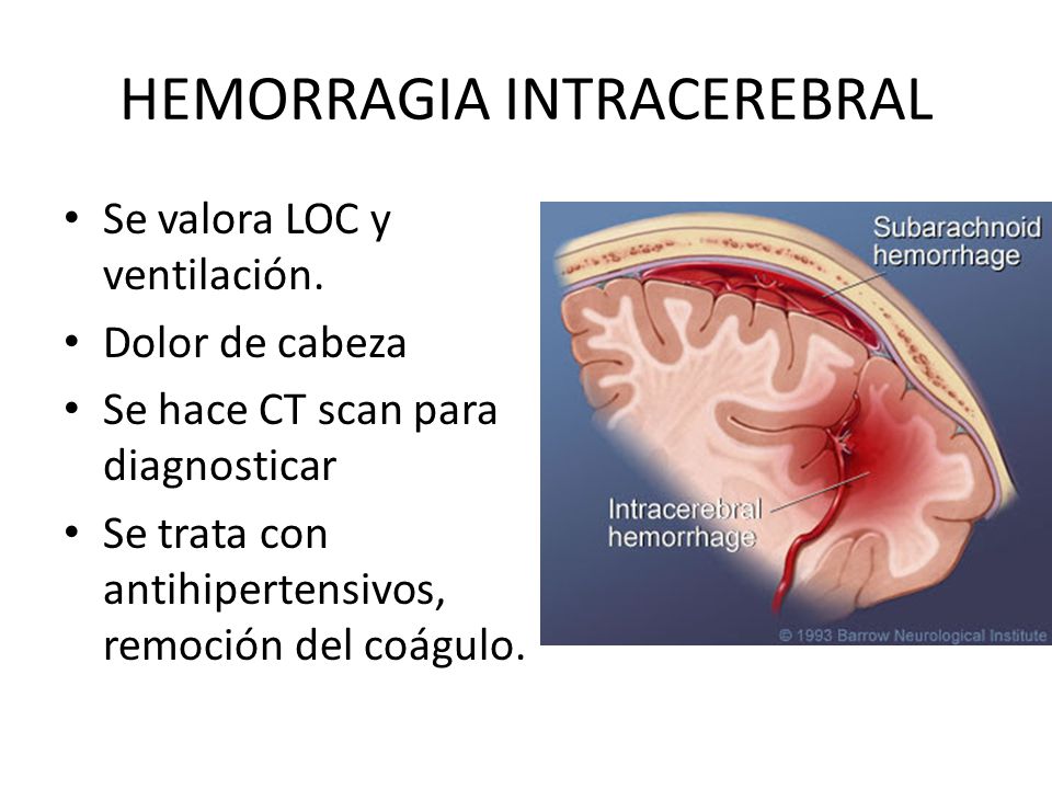 Si duele los riñones como curar